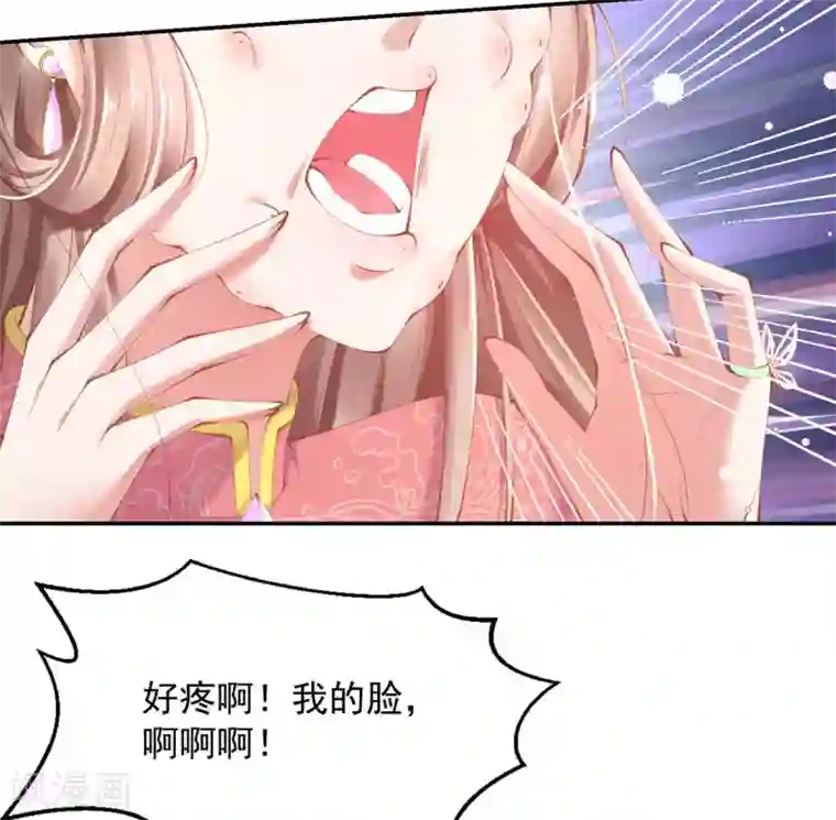 嗜血医妃第20话 先收点利息