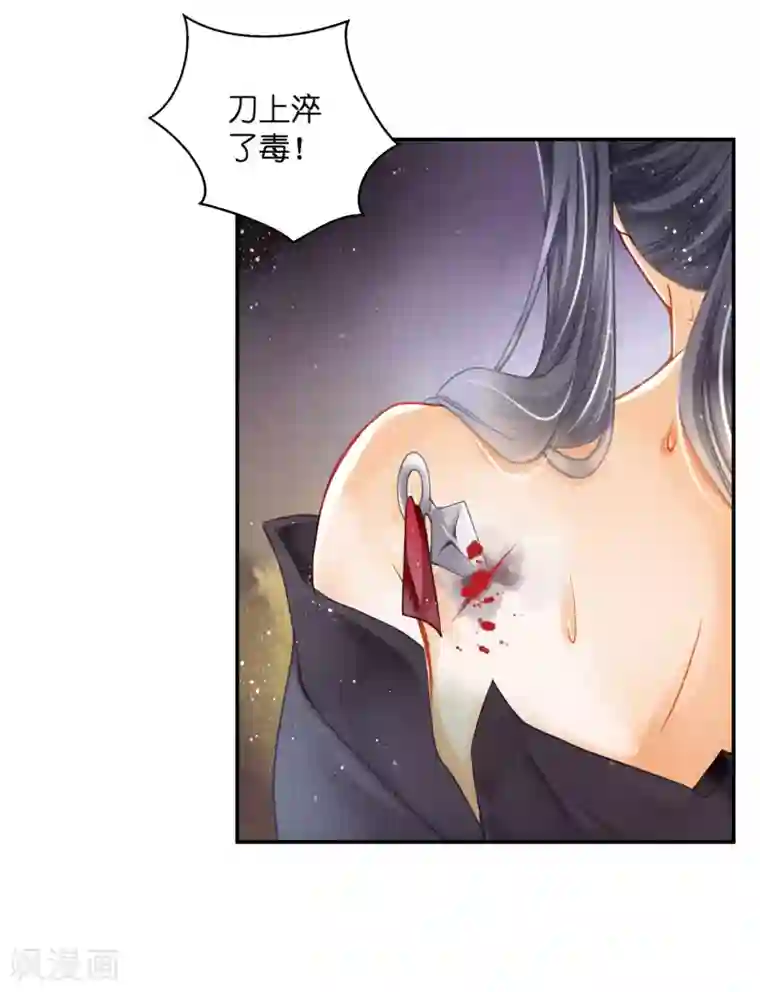 爱上无敌俏皇后第147话 为皇上宽衣解毒