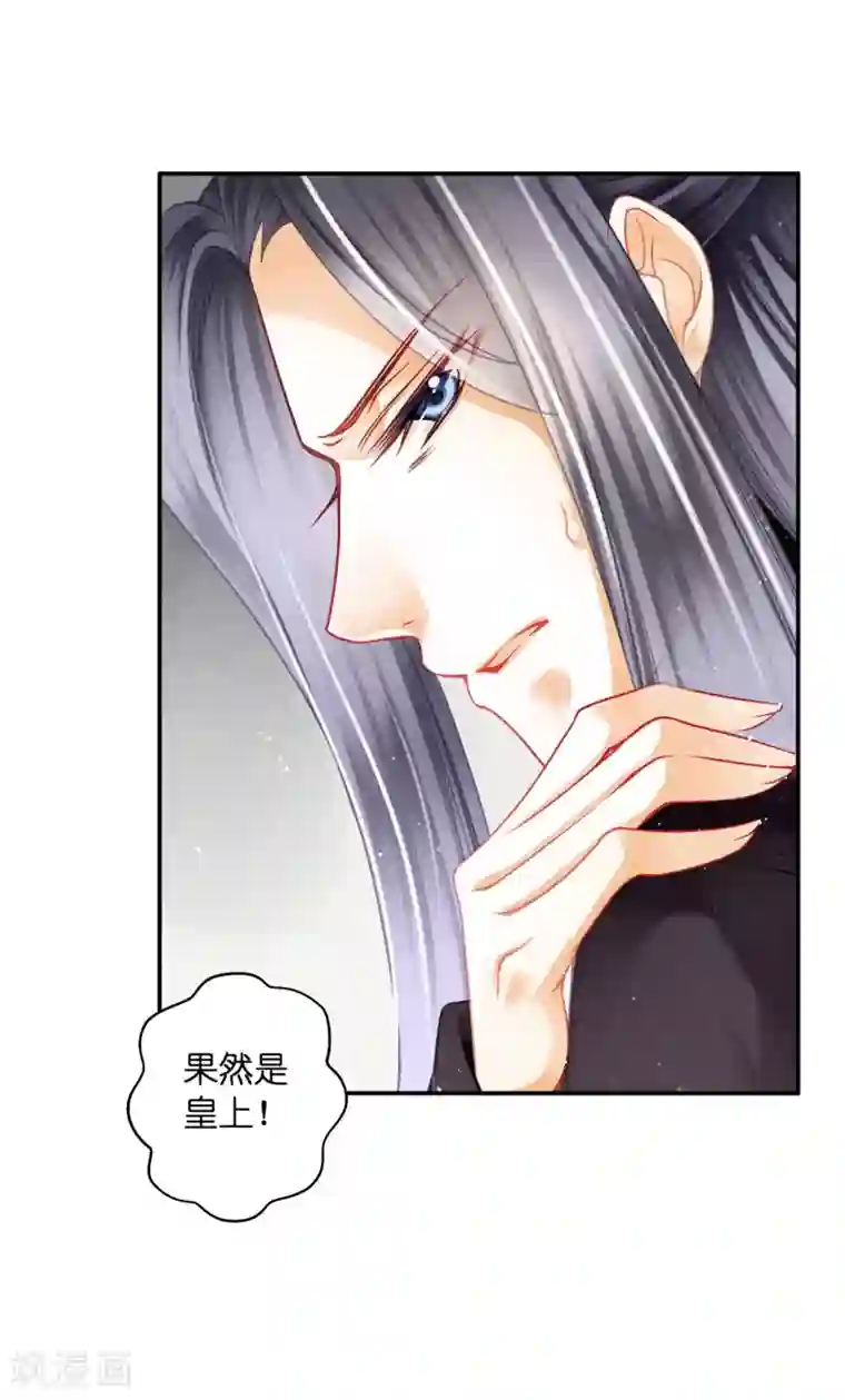 爱上无敌俏皇后第147话 为皇上宽衣解毒