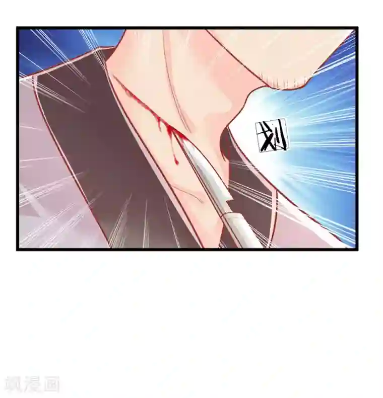 医妃权倾天下第136话 反击，生死搏命