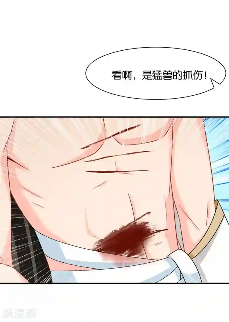 绝色医妃第175话 你也脱