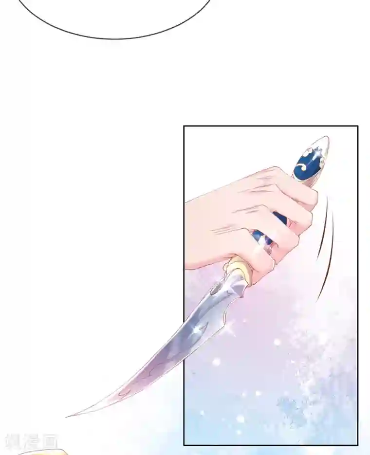 嗜血医妃第37话 准备医治