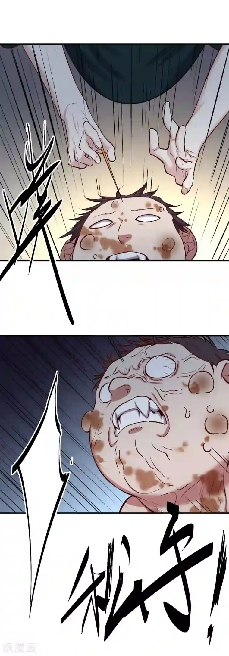 巅峰神医第67话 镇天三针