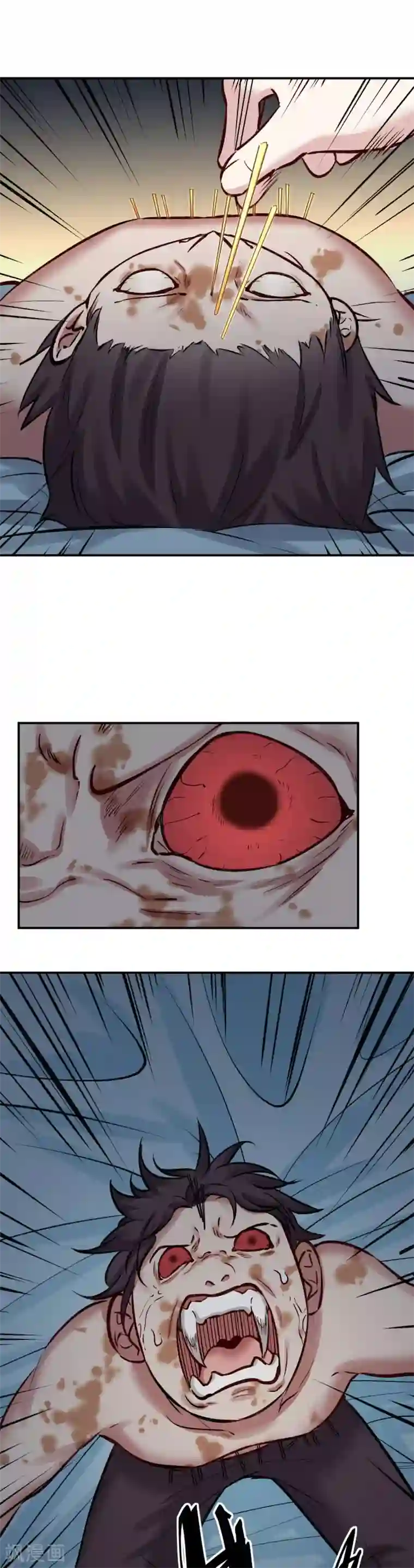 巅峰神医第68话 转机