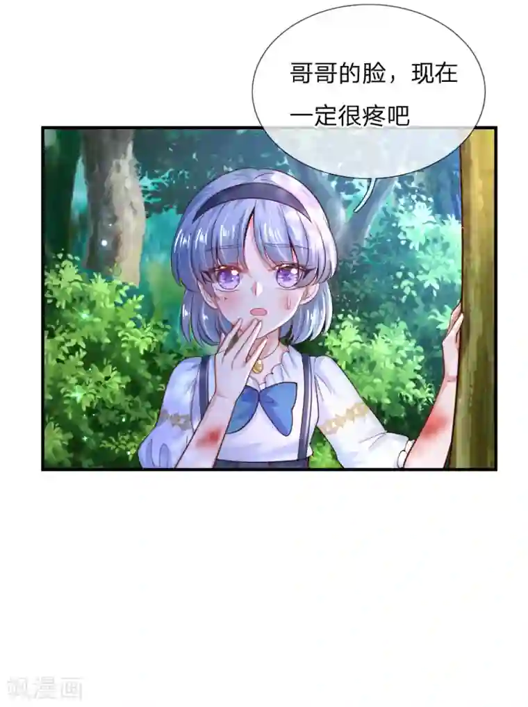 某天成为王的女儿第192话 哥哥被打得好惨呐