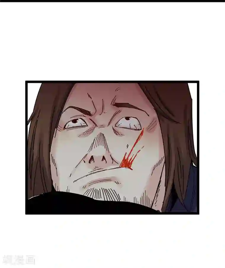 巅峰神医第74话 丢人