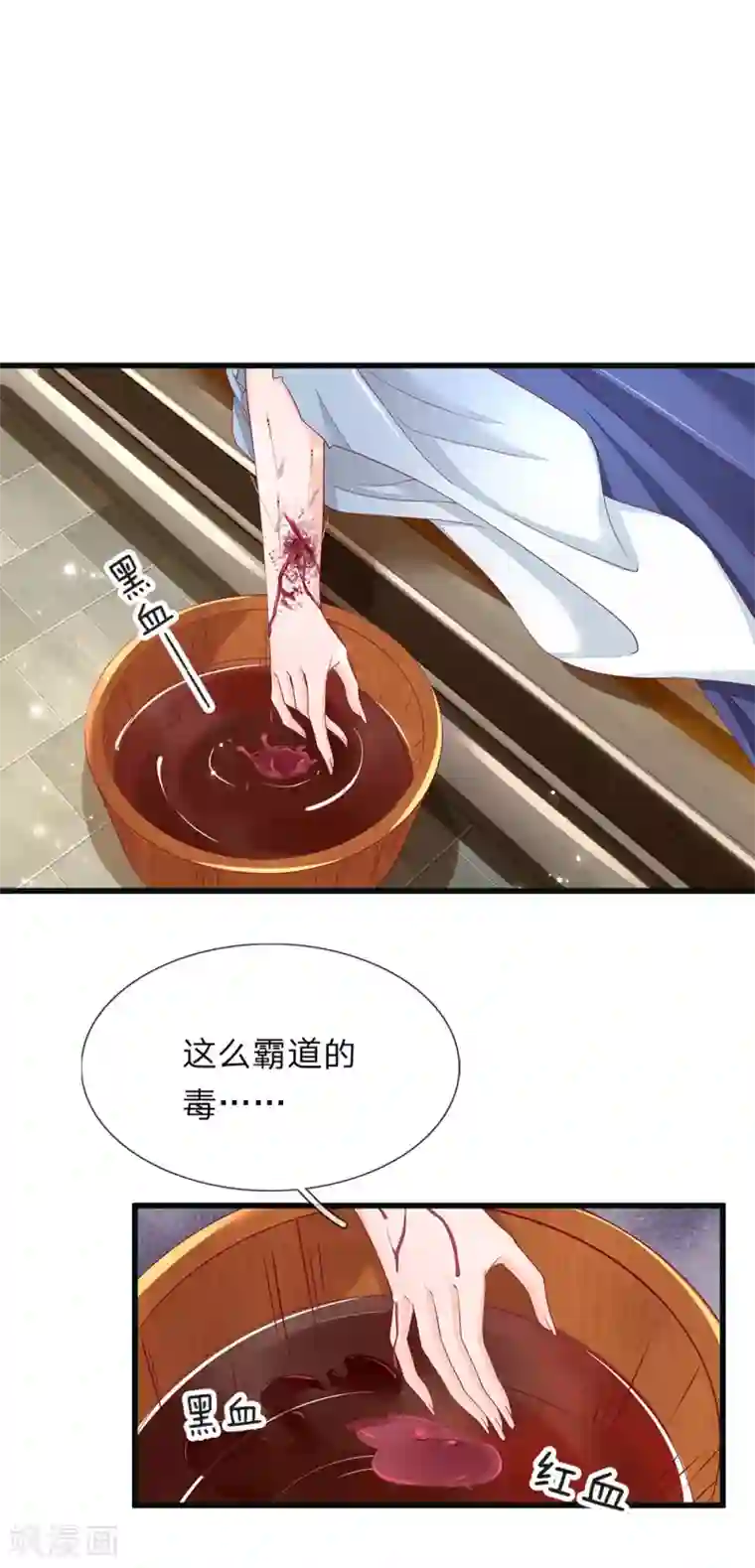 医后唳天：神医嫡女狠角色第78话 放血解毒