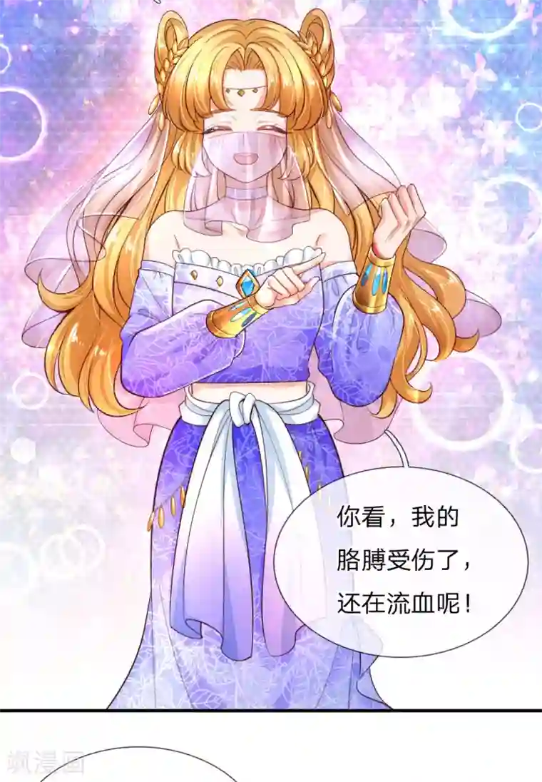 某天成为王的女儿第210话 小哥哥我受伤了呢