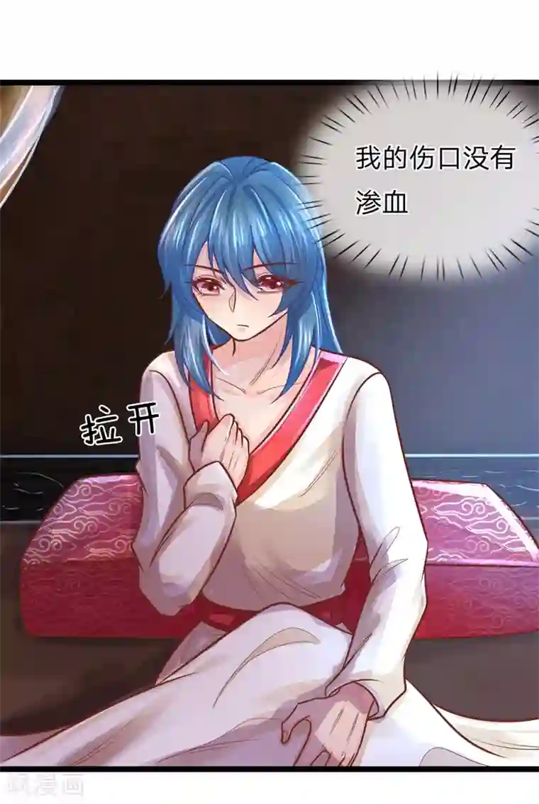 医妃权倾天下第161话 受伤，咱俩不熟