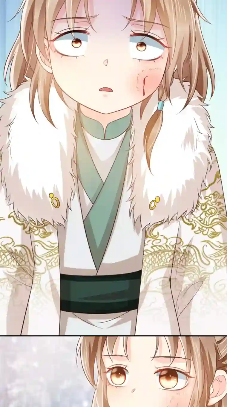 痴傻毒妃不好惹第132话 凤兰翌.步步误