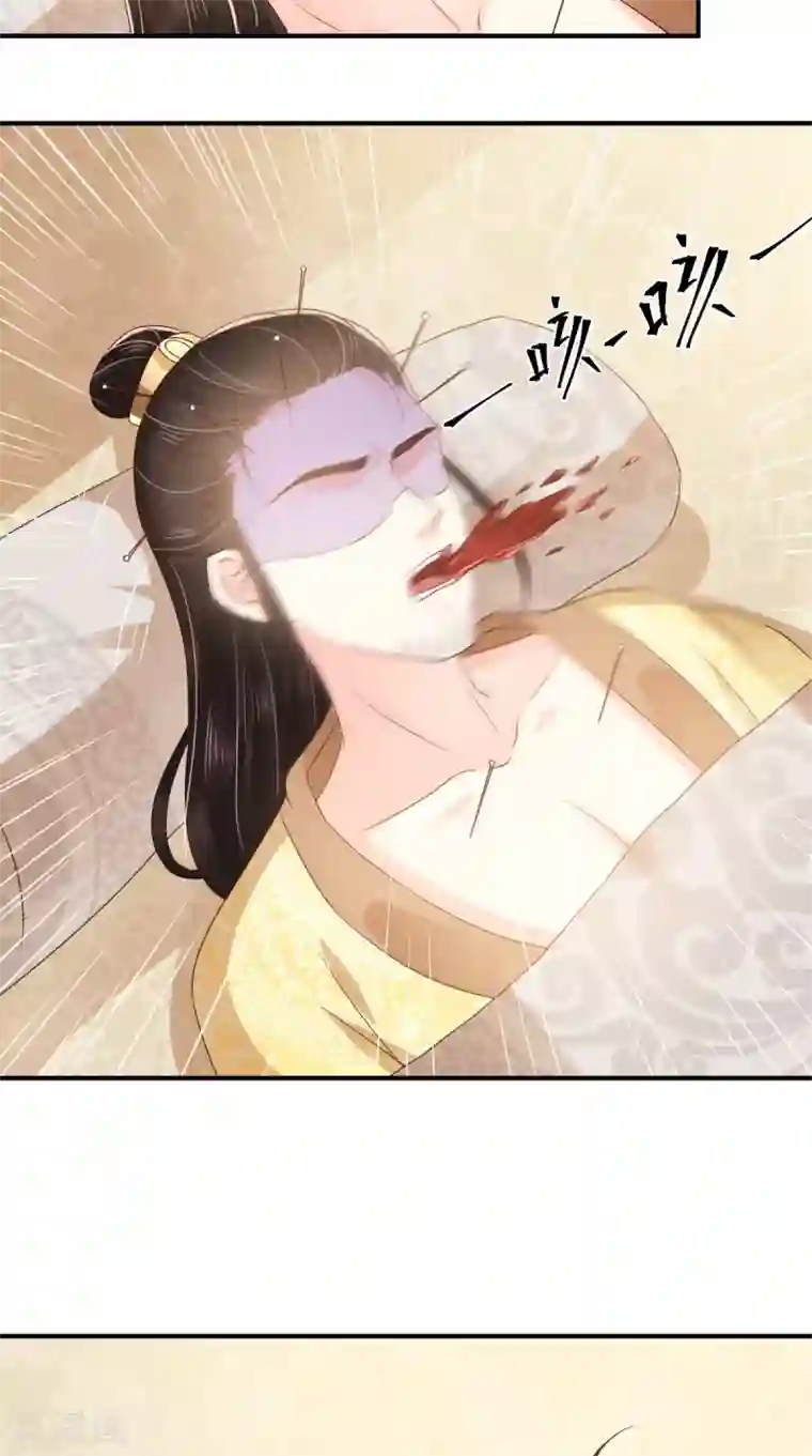 痴傻毒妃不好惹第133话 一命换一命？