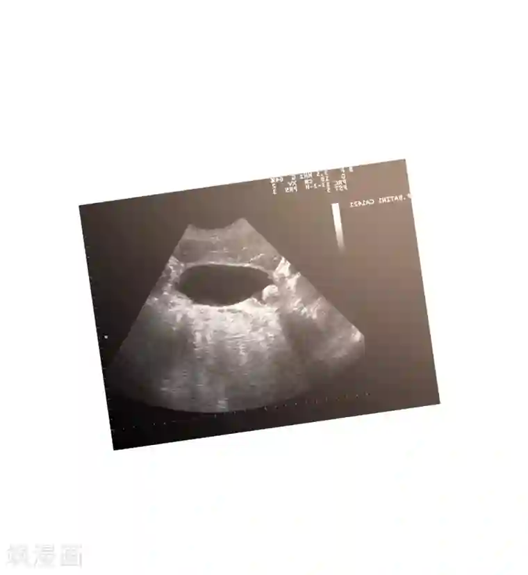 影子侦探第11话 妹妹的信