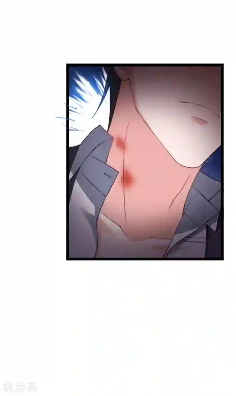 影后老婆不许逃第147话 这女人，不能留她！