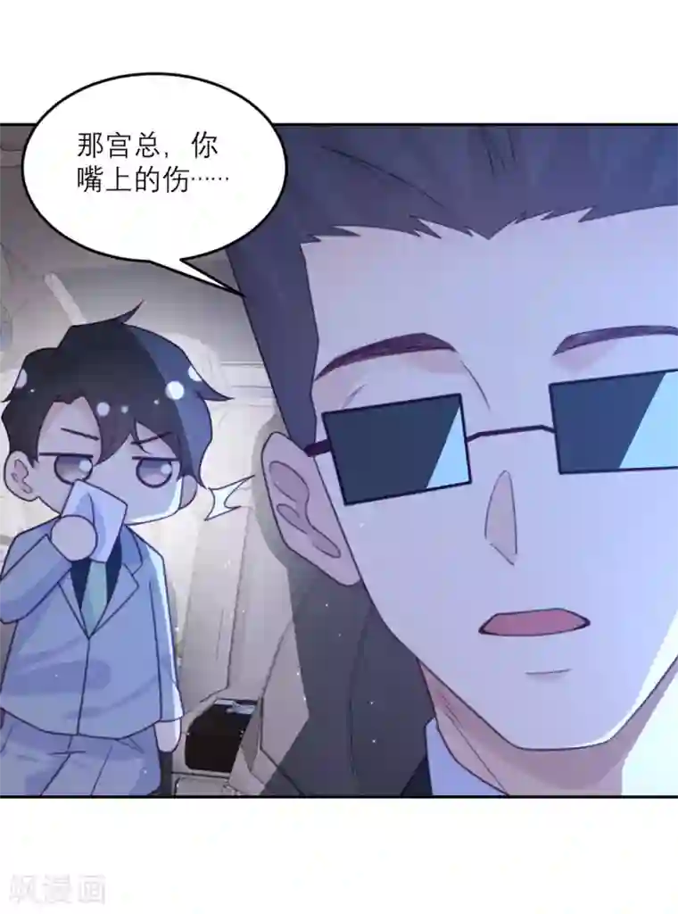 向黑化总裁献上沙雕第88话 宫总，你不对劲