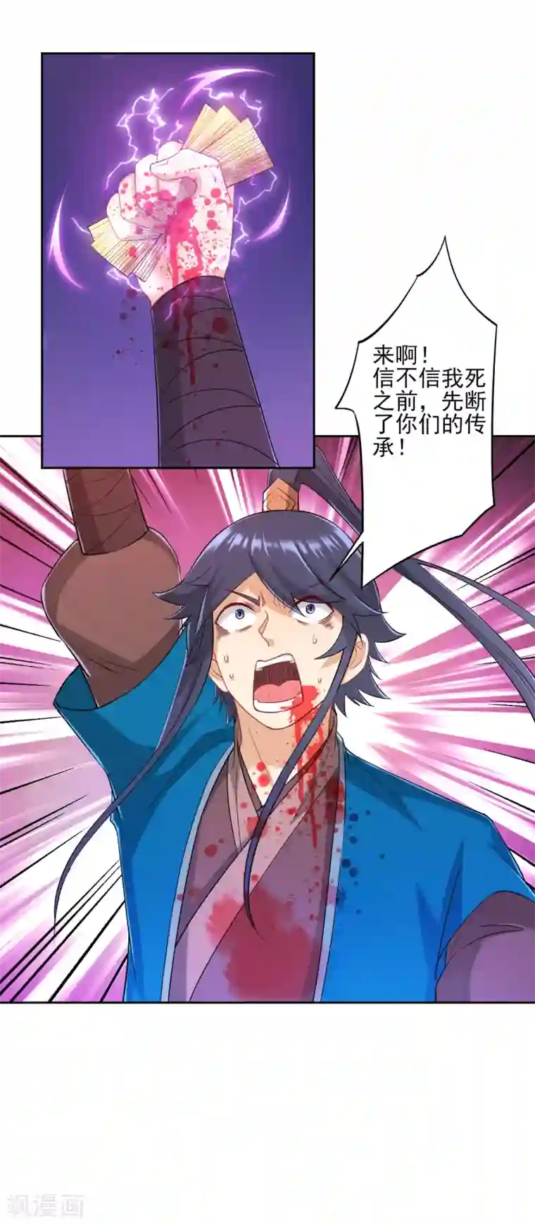 一等家丁第232话 受伤