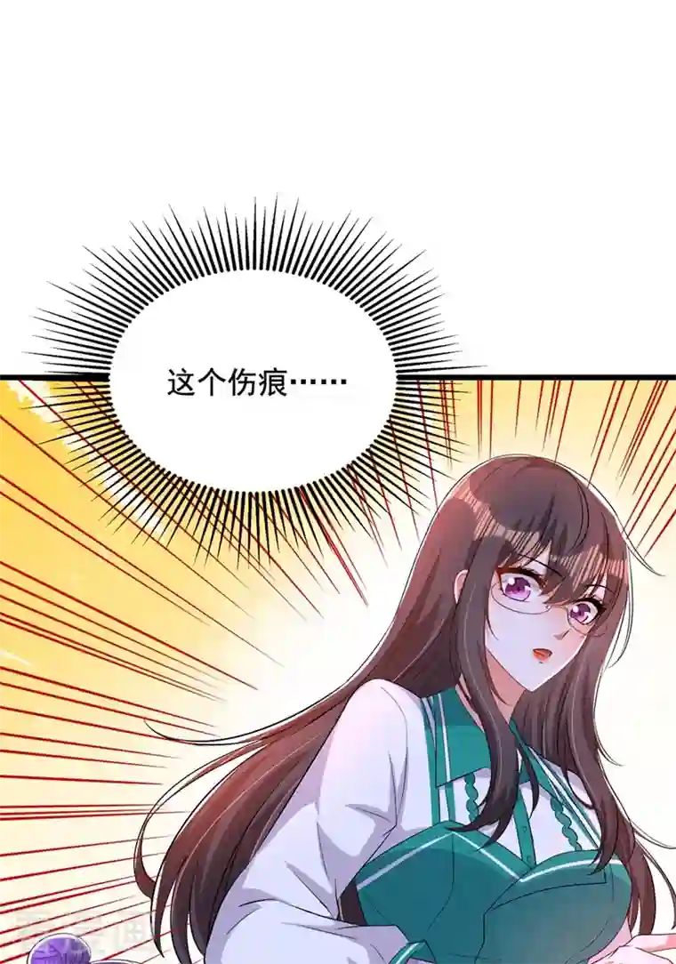 重生空间：豪门辣妻不好惹第205话 你手上的伤……