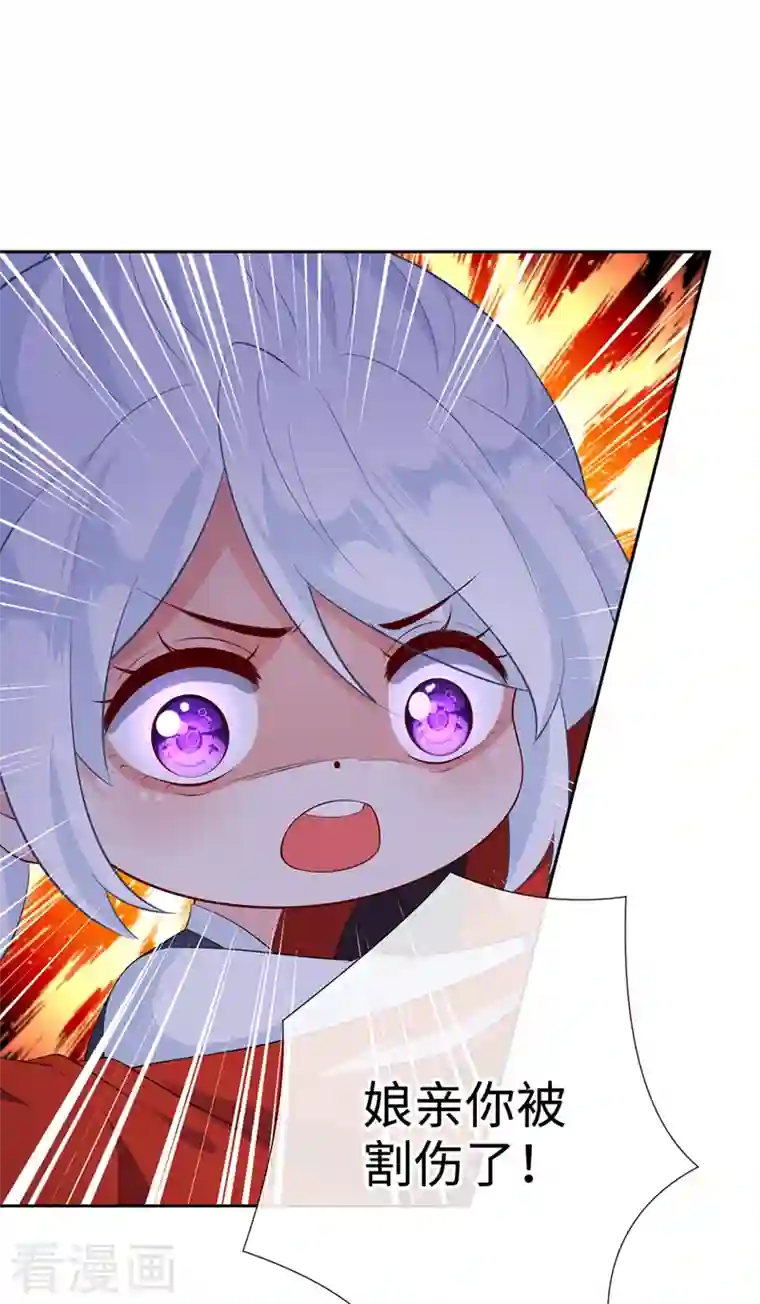 兽黑狂妃第115话 娘亲你被割伤了！