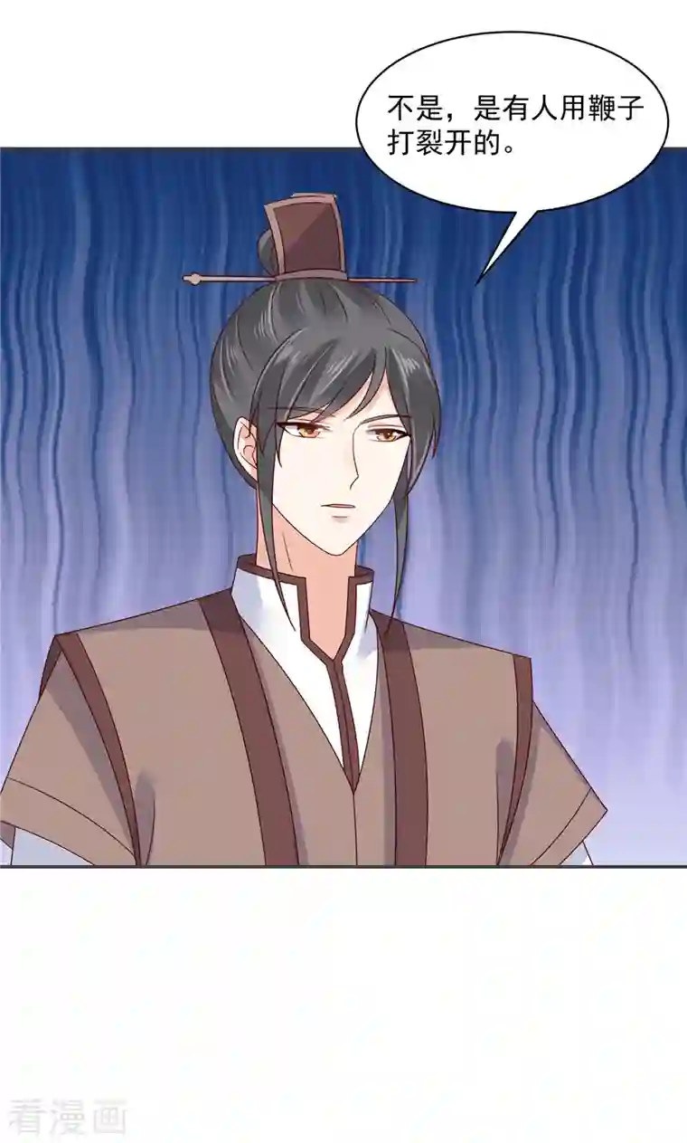 神偷王妃：我家王爷惹不起第58话 对不起没保护好你