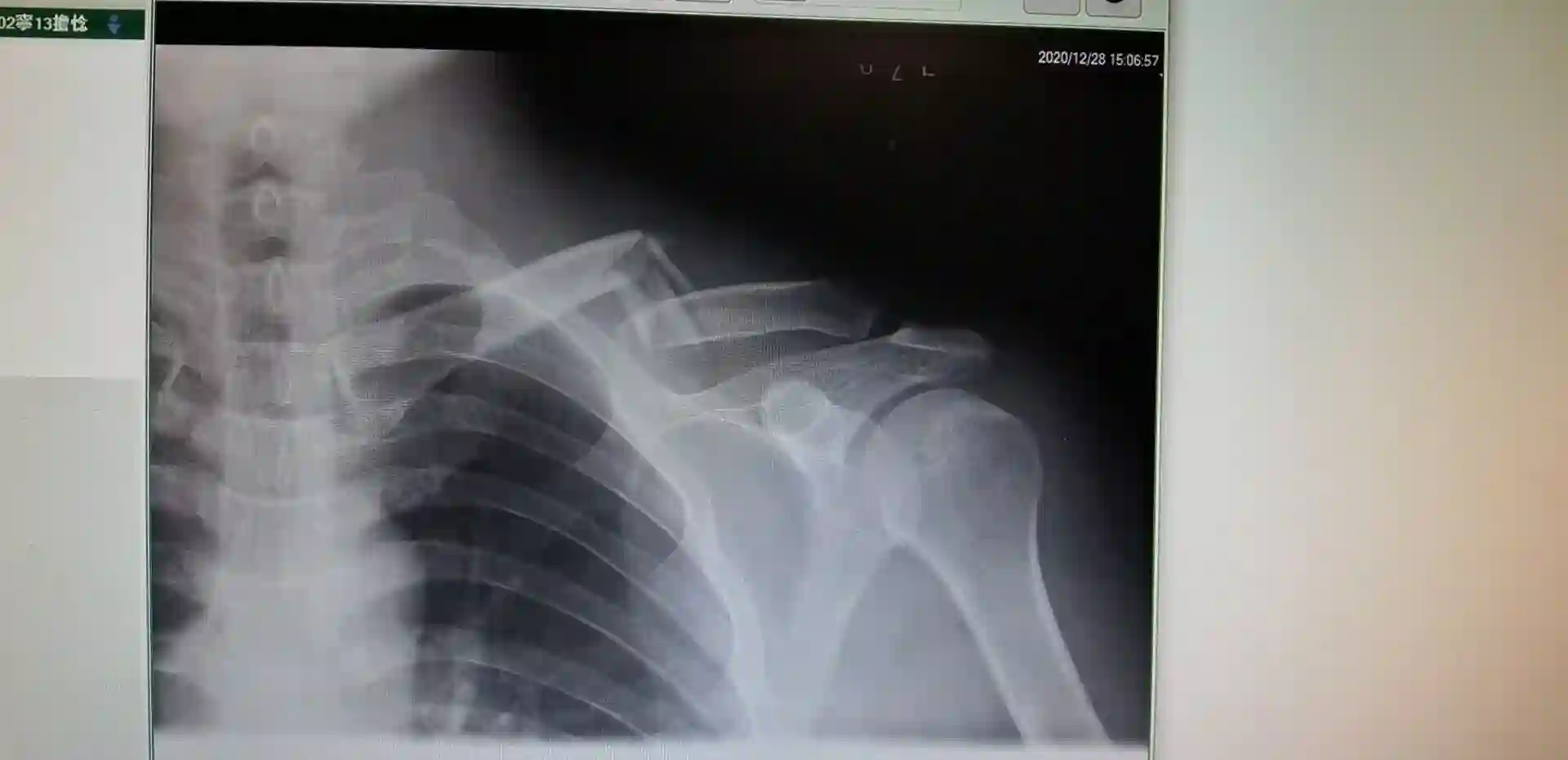 爱德蒙似乎在大海贼时代成为了复仇者的样子通告