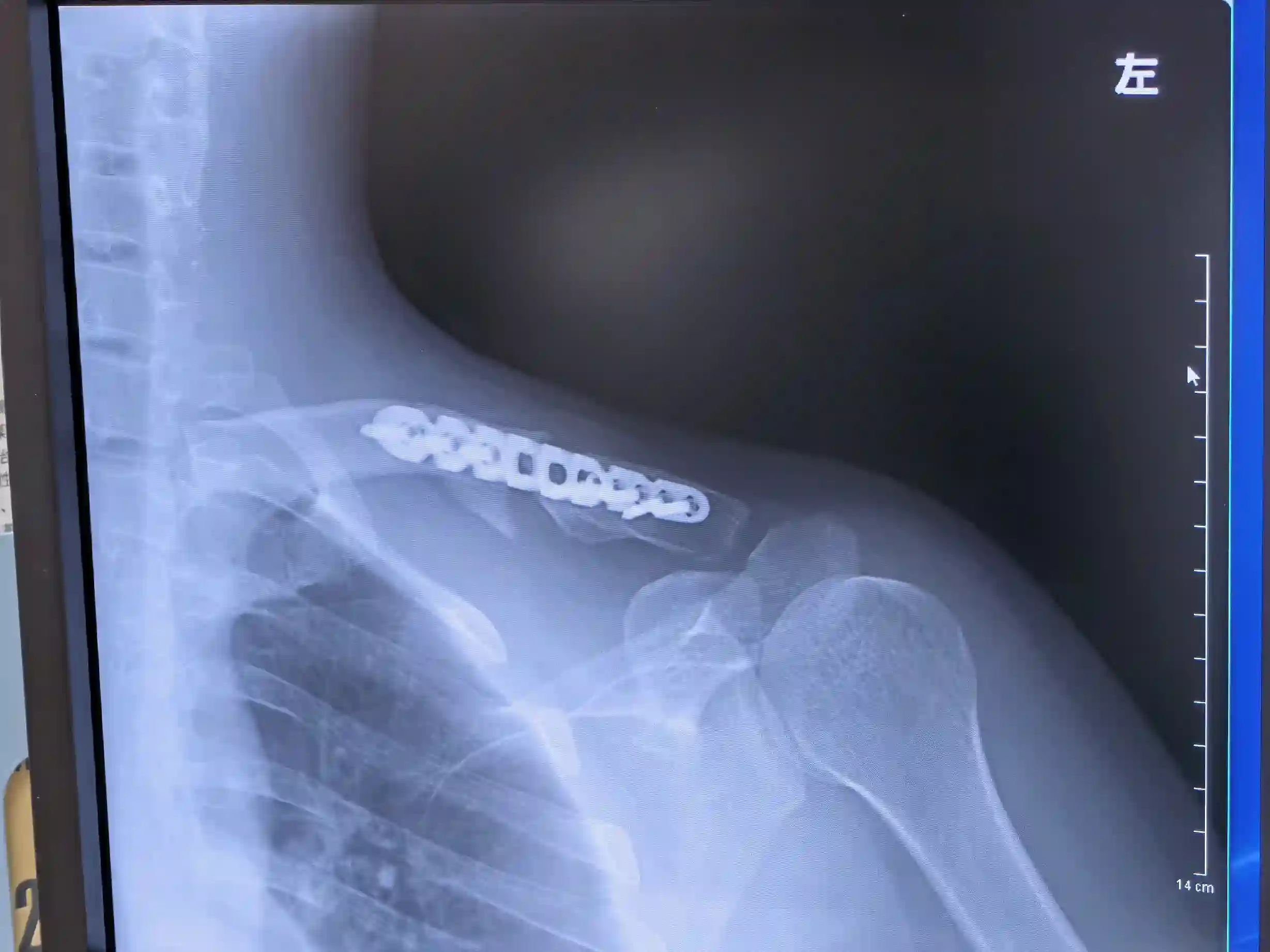 爱德蒙似乎在大海贼时代成为了复仇者的样子第19话