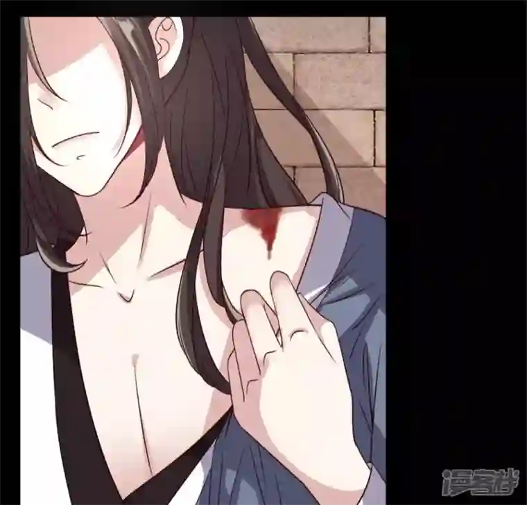 我的血族大人第74话 吸出毒血