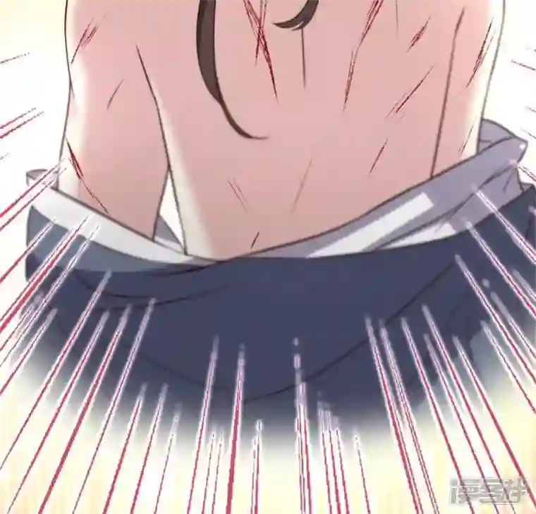 我的血族大人第83话 伤痕