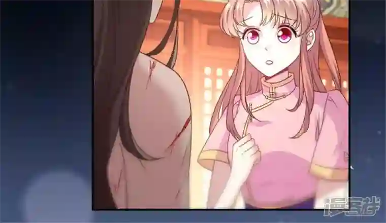 我的血族大人第83话 伤痕