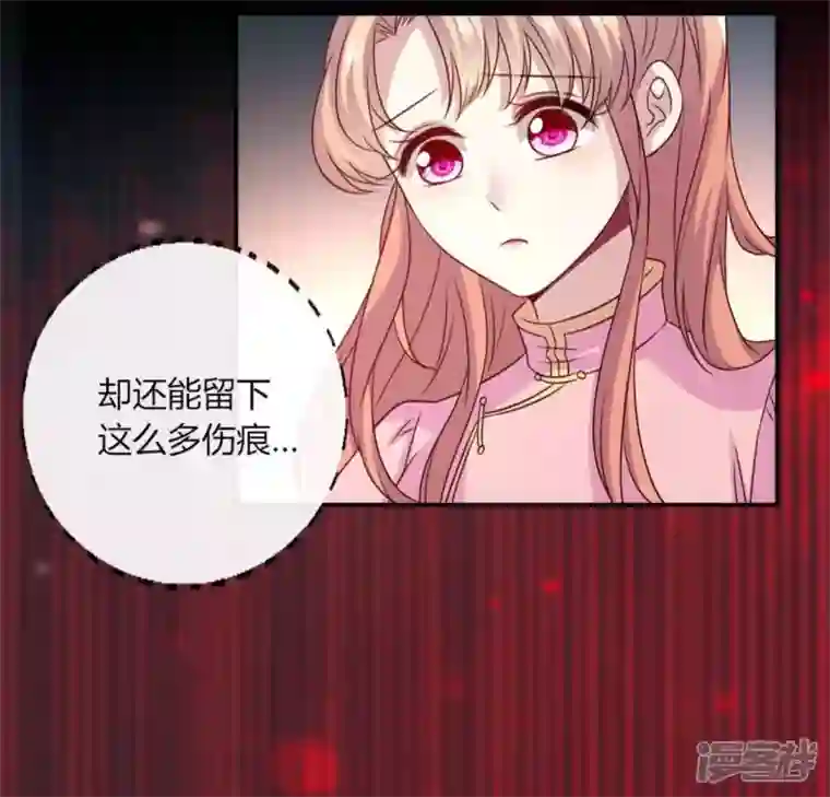 我的血族大人第83话 伤痕