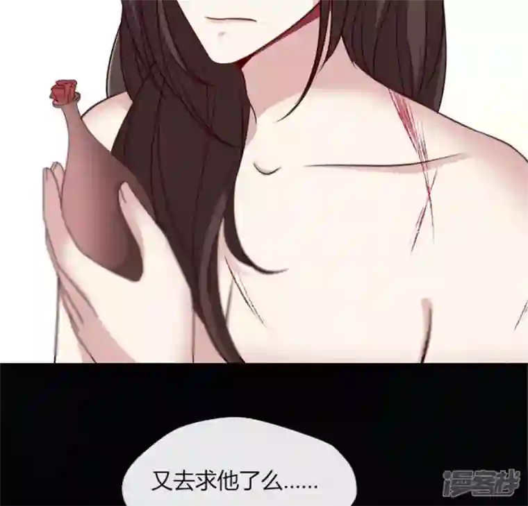 我的血族大人第83话 伤痕