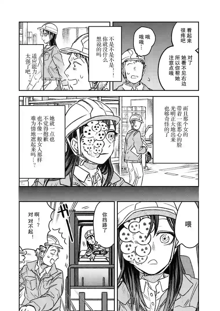 与面疮相伴第08话