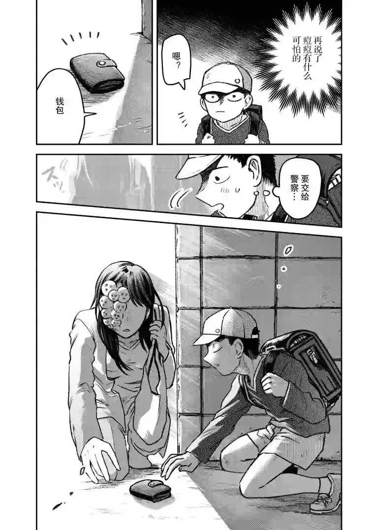 与面疮相伴第26话