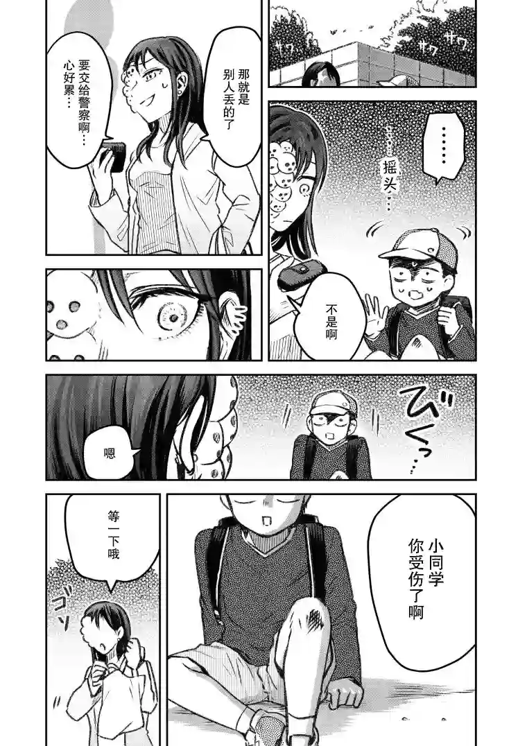 与面疮相伴第26话