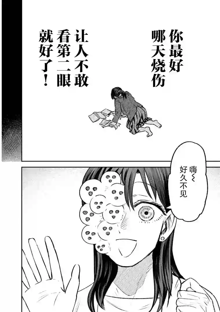 与面疮相伴第41话