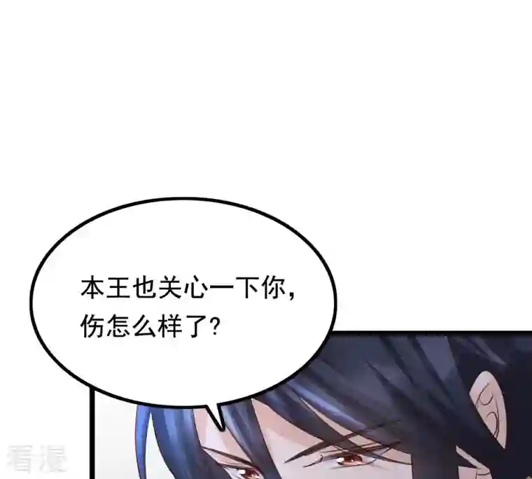 战神狂妃：凤倾天下第79话 互相关心