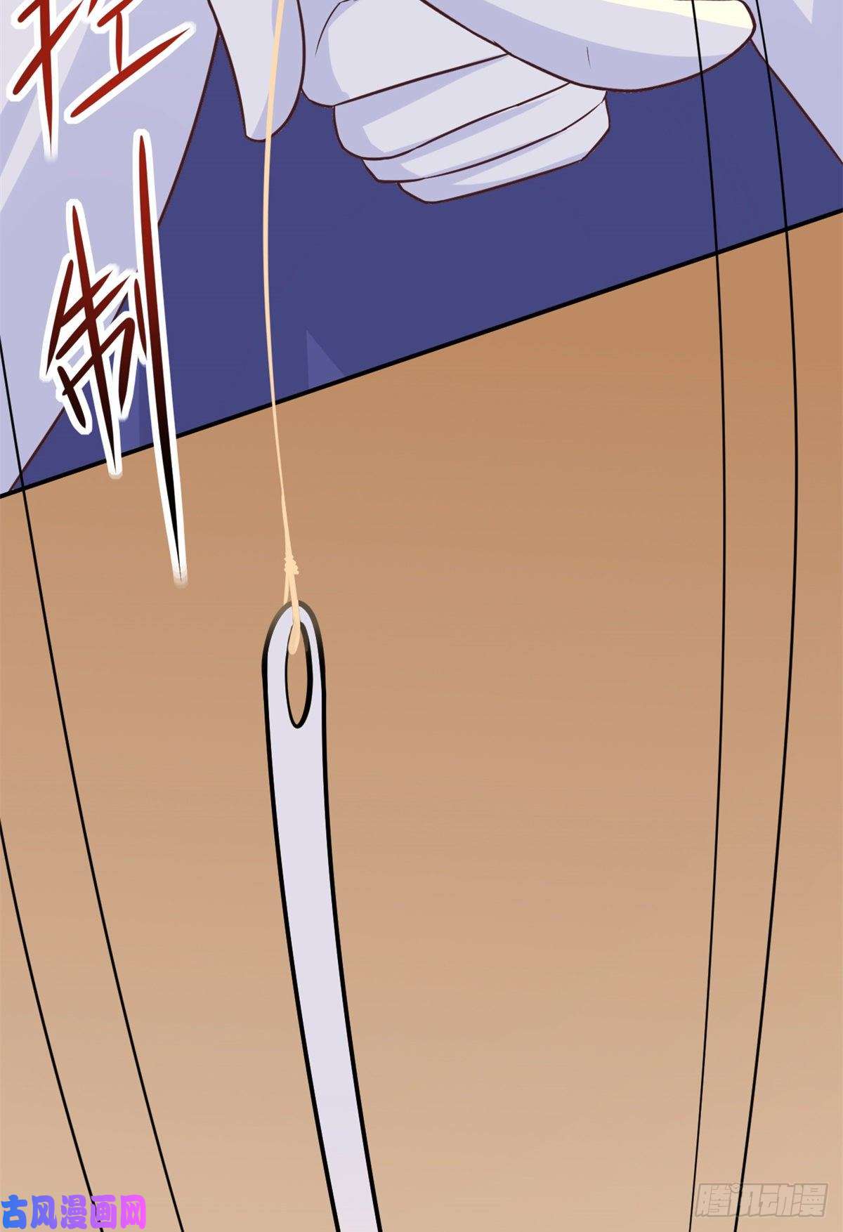 当医生开了外挂04 肌腱缝合手术