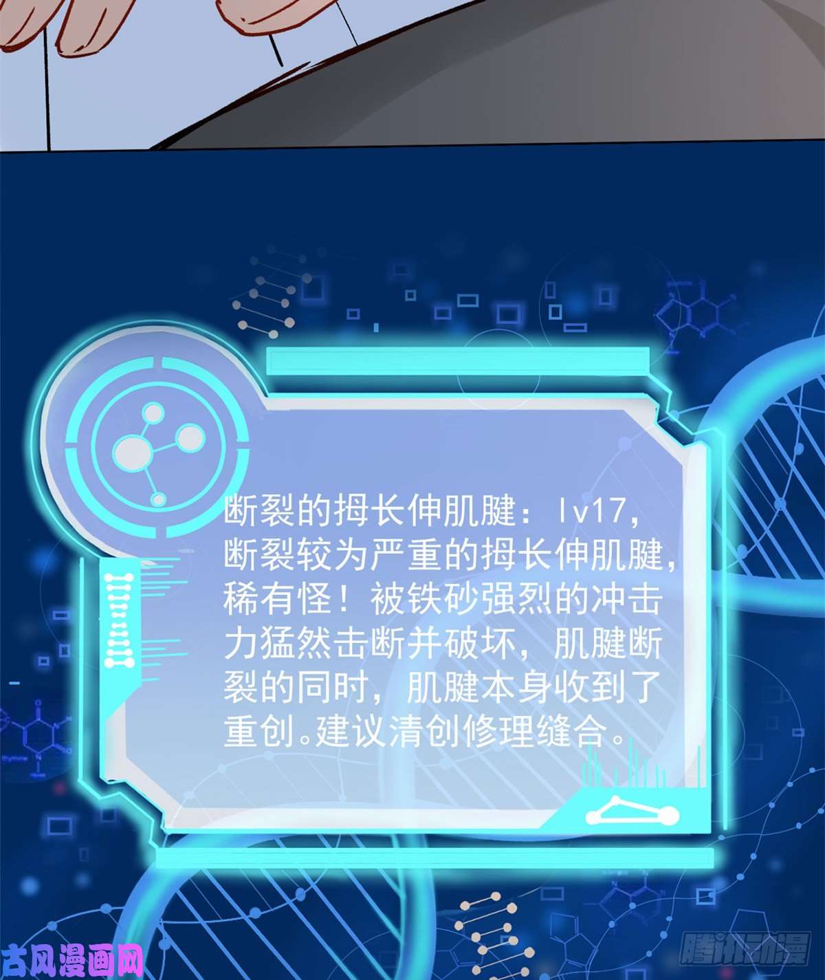 当医生开了外挂04 肌腱缝合手术