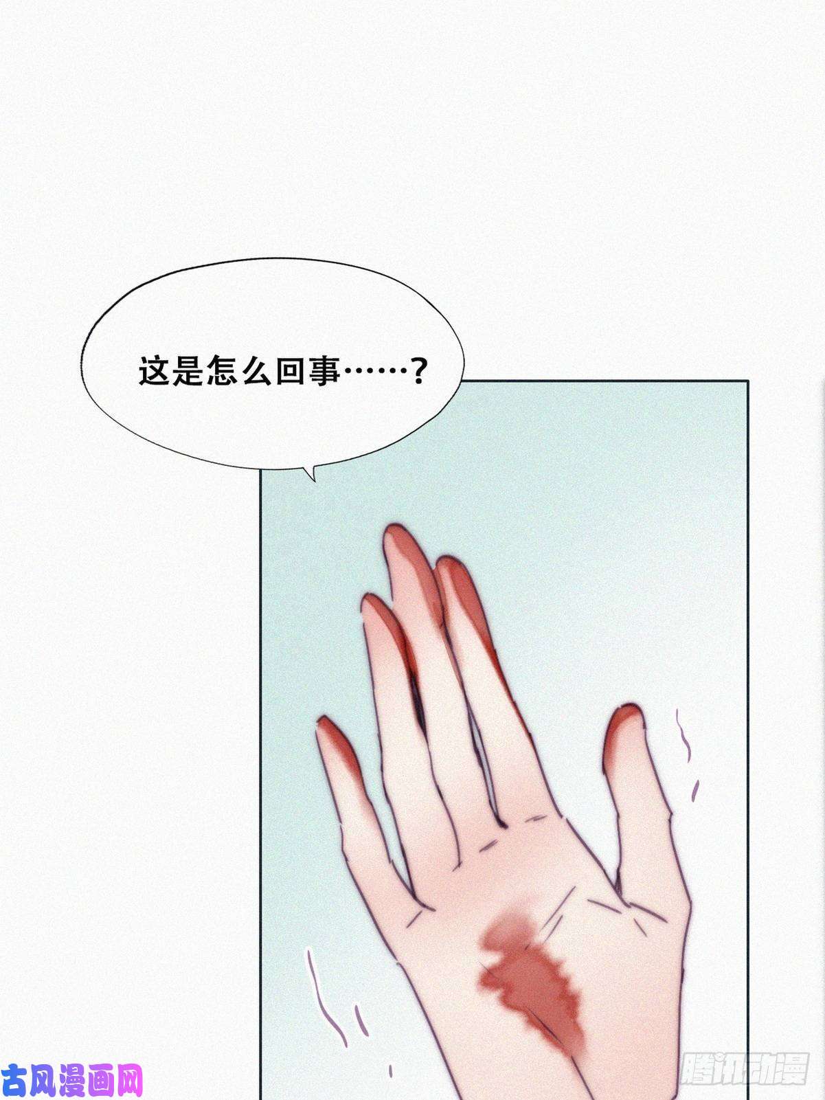 逆袭之好孕人生第144话 瞿城受伤