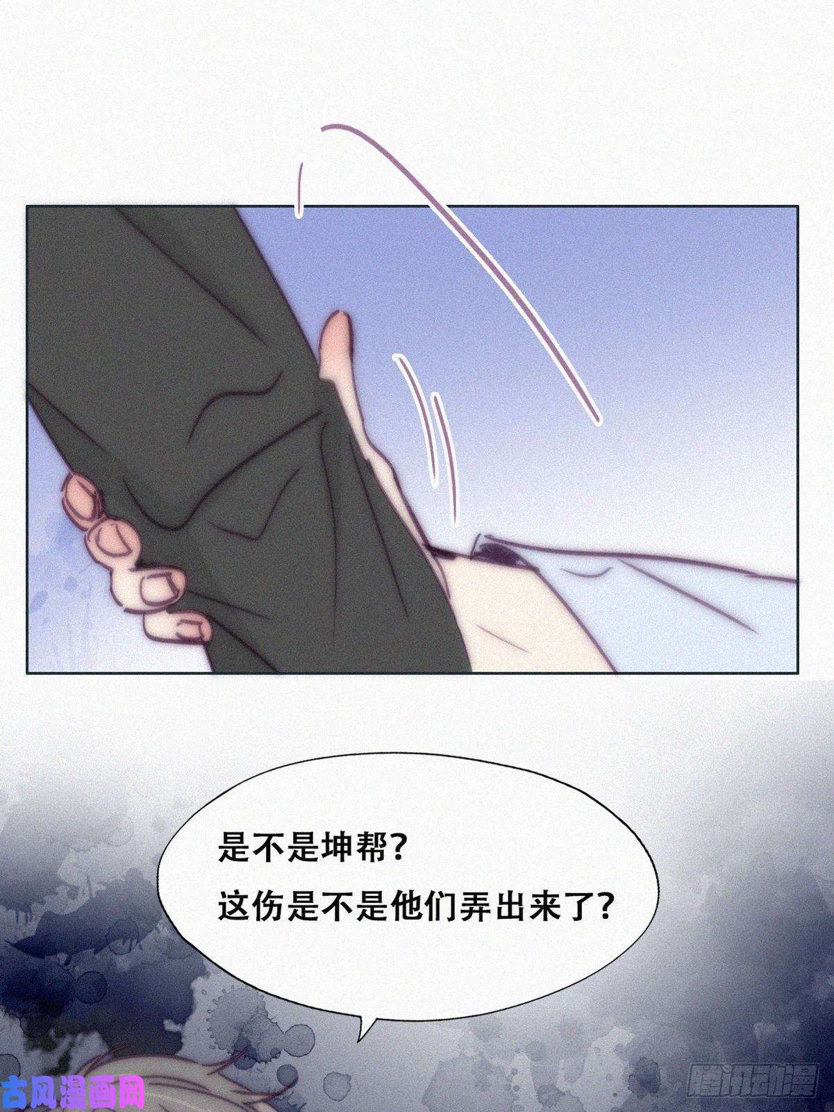 逆袭之好孕人生第144话 瞿城受伤