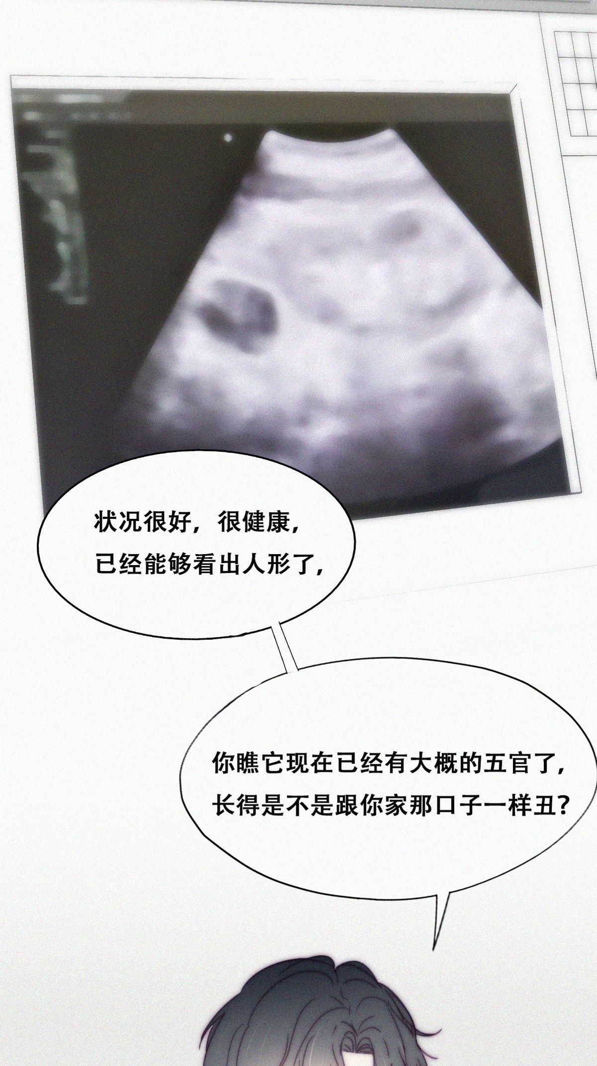 逆袭之好孕人生143 急刹车？