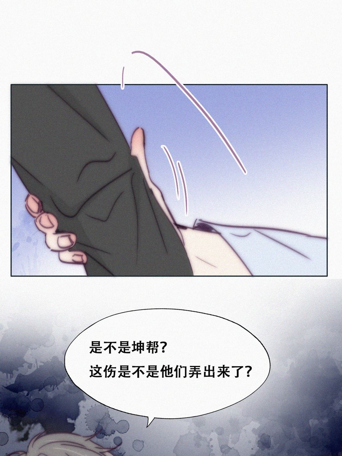 逆袭之好孕人生147 瞿城受伤