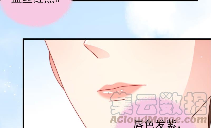少帅每天都在吃醋第186话 毒已入骨