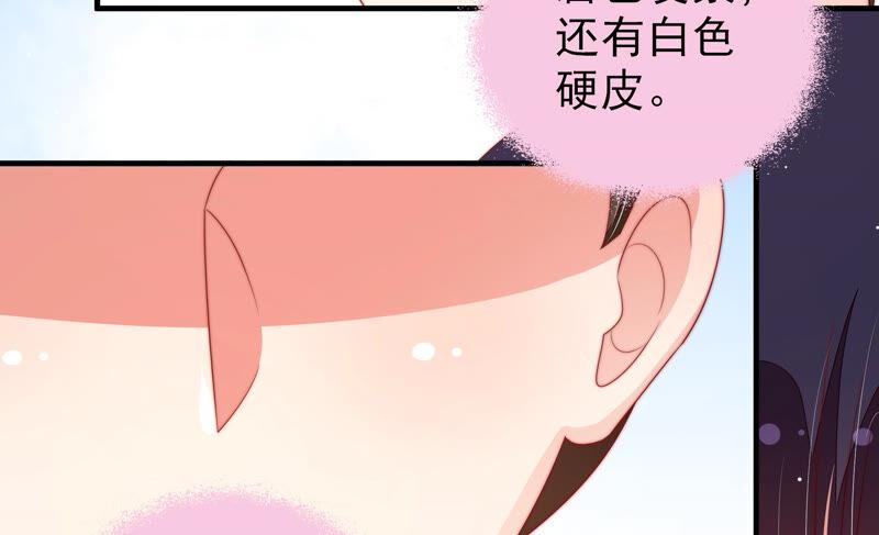 少帅每天都在吃醋第186话 毒已入骨