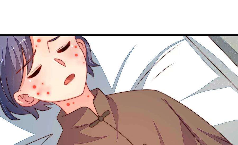 少帅每天都在吃醋第319话 天花