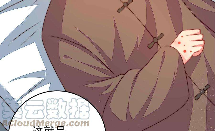 少帅每天都在吃醋第319话 天花