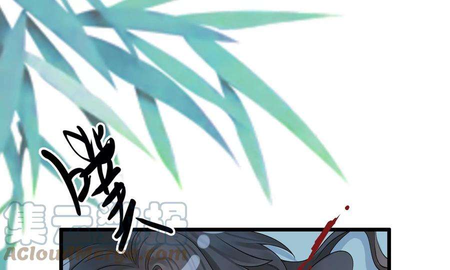 太子，你好甜85话 真受伤