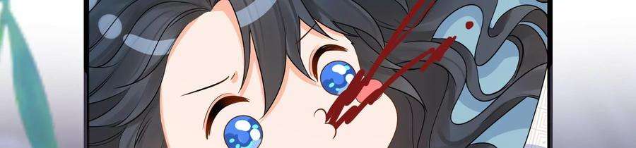 太子，你好甜85话 真受伤