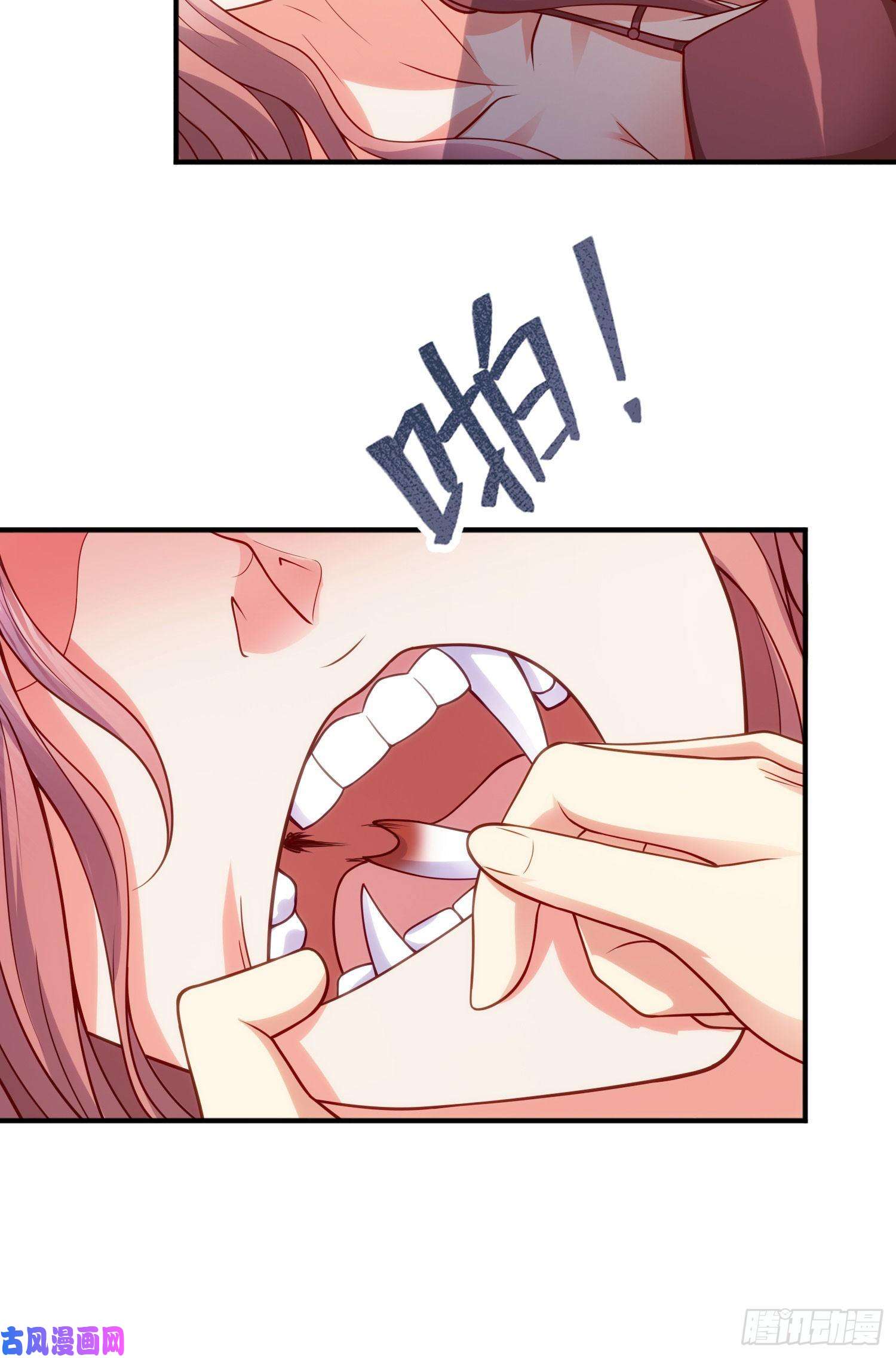 开局强吻裂口女第31话 以牙还牙！