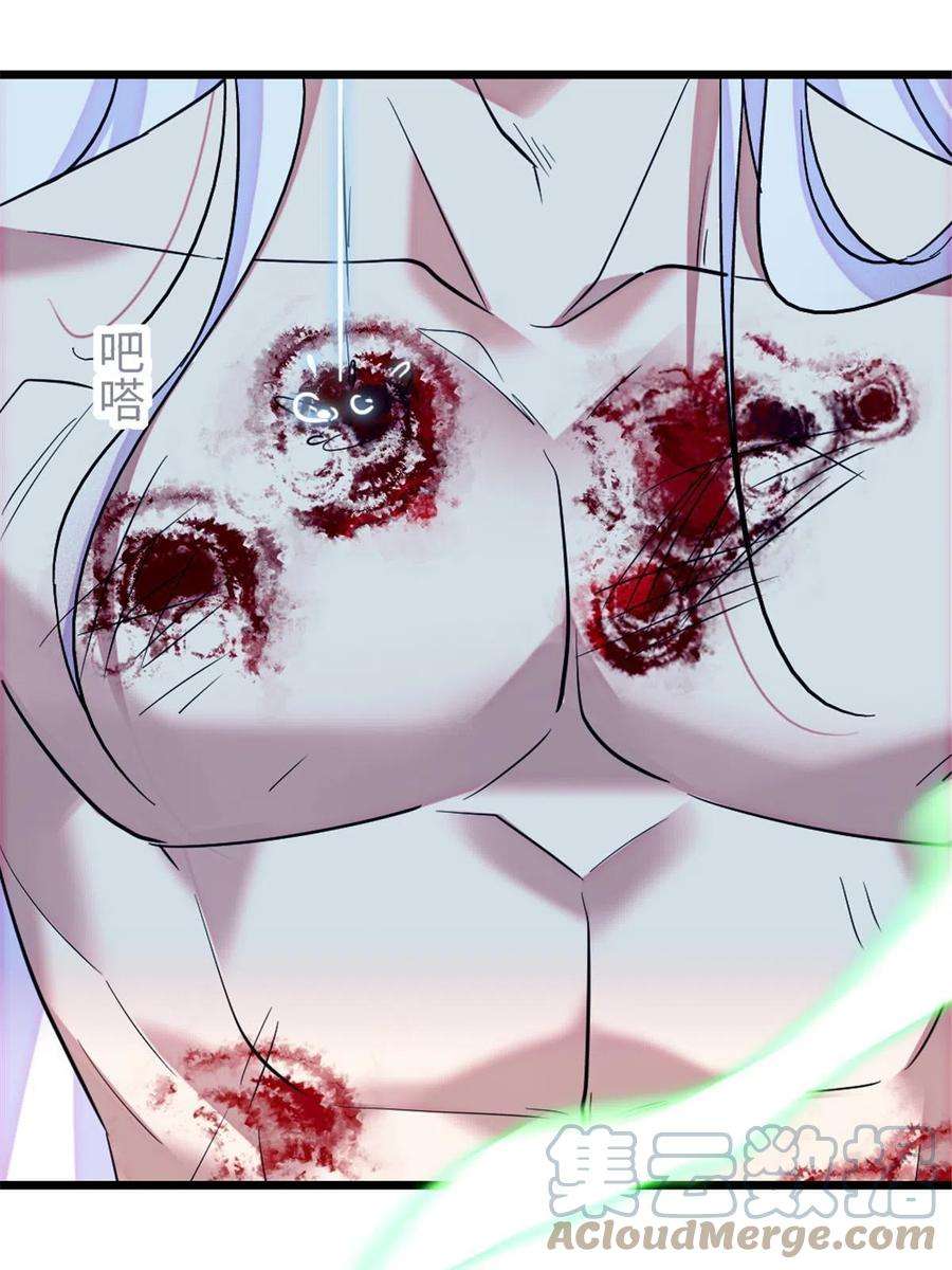 萌动兽世87 重伤