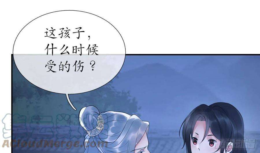 打死也不做师尊95话 小尘手腕也有伤
