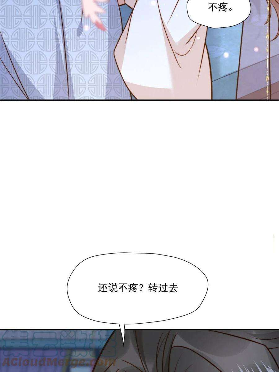 摆烂后我掌控王爷芳心27 上药
